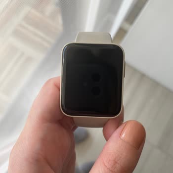 Xiaomi Saatim Bozuldu Teknik Servis Sağlam Ürüne Darbe Almış Dedi