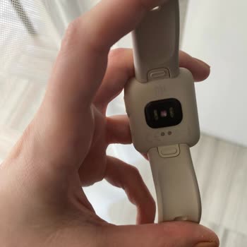 Güncel Dijital Xiaomi Saatim Bozuldu Teknik Servis Sağlam Ürüne Darbe Almış Dedi