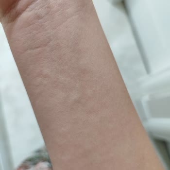 DAY2DAY Collagen Alerji Yaptı.