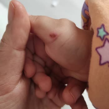 İSADEM Çocuğumun Isırılması Ve Eğitmenin Yalan Söylemesi