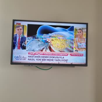 Fox Tv İyi Çekmiyor Bozuluyor