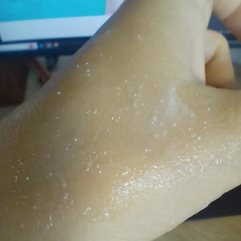 Abdi İbrahim Şüpheli Clozaril Krem