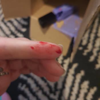 Gratis Kirik Gönderiler Ürün Parmağımı Kesti