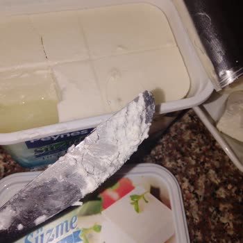 Peynes Peynirden Saç Çıkması