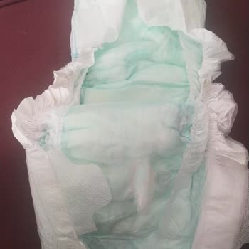 Molfix Bebek Bezi Hatalı Ve Kalite Düşüklüğü