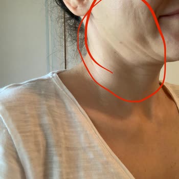 Medicall Clinic Güzellik Hizmetleri 10 Yaş Yaşlandırdı Yüzümü