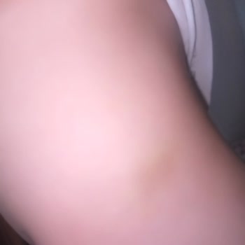 Mucit Yumurcak Anaokulu'nda Çocuğuma Psikolojik ve Fiziksel Şiddet