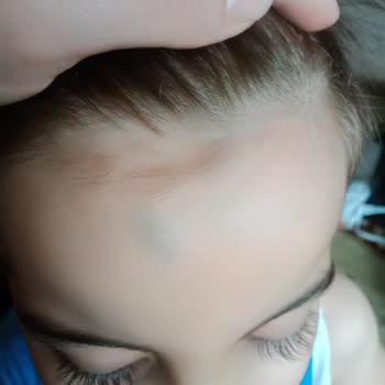 Mucit Yumurcak Anaokulu'nda Çocuğuma Psikolojik ve Fiziksel Şiddet