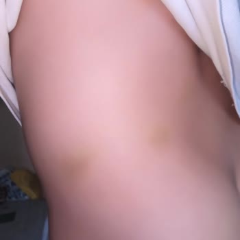 Mucit Yumurcak Anaokulu'nda Çocuğuma Psikolojik ve Fiziksel Şiddet