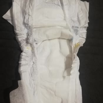 Molfix Bez Yeni Nesil Pişik Ve Sızdırma