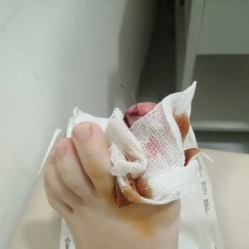 Yataş Baza Zımba Teli Kızımın Ayağına Battı