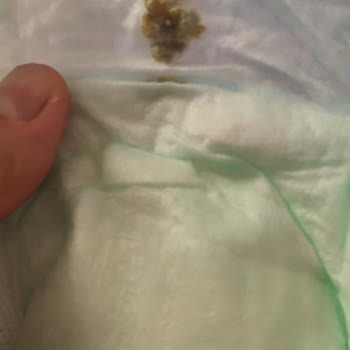 Molfix 5 Numara Bezde Yapışkan Madde