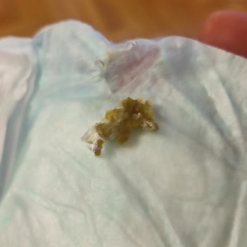 Molfix 5 Numara Bezde Yapışkan Madde