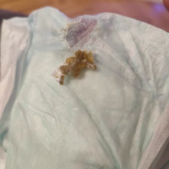 Molfix 5 Numara Bezde Yapışkan Madde