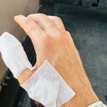 Crystal Hotels Sunset Otel Duşa Kabin Patlaması