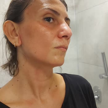 Nivea'ya Dikkat Yüzümü Yaktı Resmen!