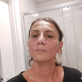 Nivea'ya Dikkat Yüzümü Yaktı Resmen!