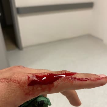 Durul Duşakabin Ürünün Parçalanarak Yaralamaya Sebep Vermesi