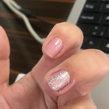 Mersin Marina Gratis Beauty Merkezi İşlem Sonrası Reaksiyonlar