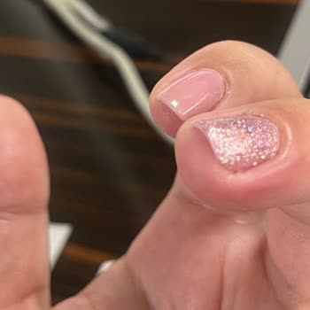 Mersin Marina Gratis Beauty Merkezi İşlem Sonrası Reaksiyonlar