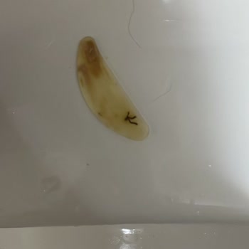 Osmanoğlu Hastanesi Doktorun Tıbbi Hatası