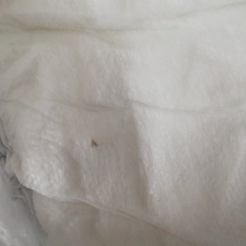 Sleepy Marka Bebek Bezi Yabancı Cisim