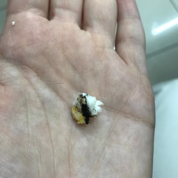 Eti Gıda Eti Gong Paketinden Böcek Çıktı