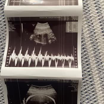 Medipol Sağlık Grubu Doğum Kontrol Muayenesi