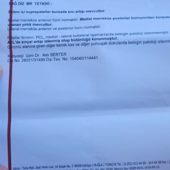 Lokman Hekim Esnaf Hastanesi (Fethiye) Fethiye Hastanesi'nde Başarısız Ameliyat Deneyimi