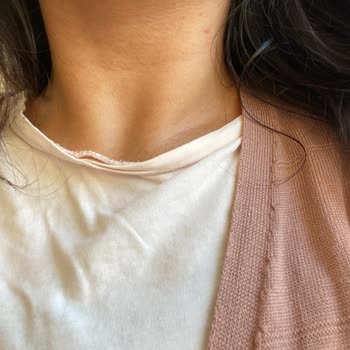 Yves Rocher Geçmeyen Saç Derisi Kaşıntısı Ve Yüzümde Oluşan Kabarcıklar