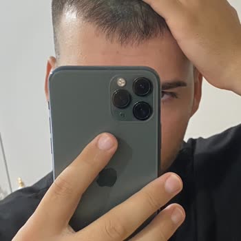 Batçı Hair Atelier Saç Kapatıcı Ürünü Hakkında Yanıltıcı Bilgilendirme Yaptı!