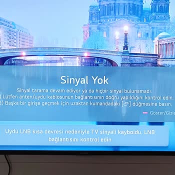 A101 Televizyon Sorunu