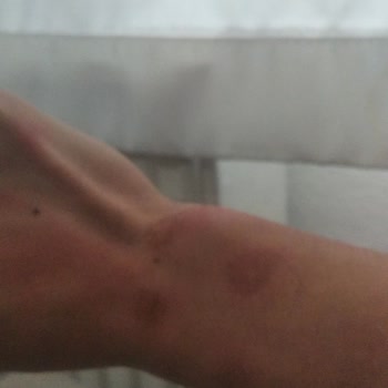 Tüy Silgisi (Kristal Epilatör) Satış Sonrası Deneyimim