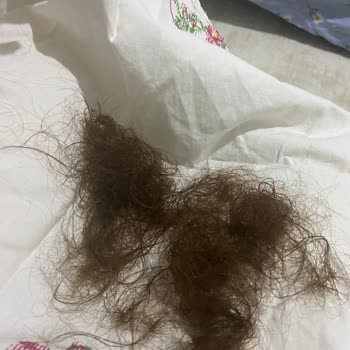 DP Şampuan Saç Dökülmesi Sorunu