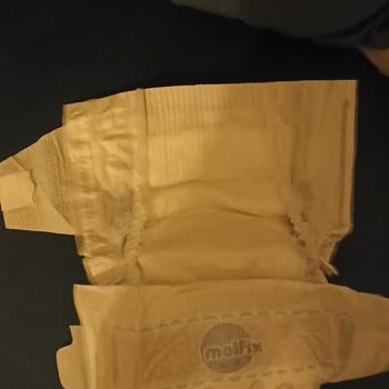 Yeni Molfix Sızıntı Ve Pişik Yapıyor