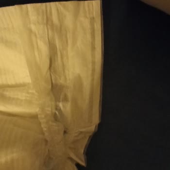 Yeni Molfix Sızıntı Ve Pişik Yapıyor