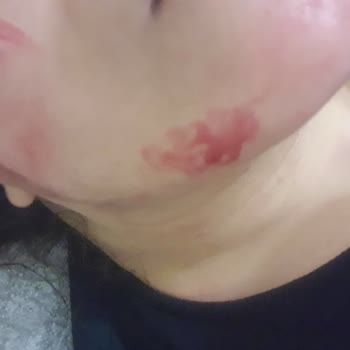 Trendyol Zühre Ana Form Macunu Yüzümü Mahvetti.