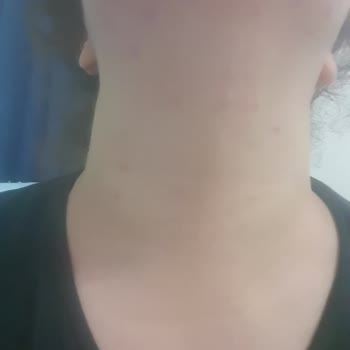 Trendyol Zühre Ana Form Macunu Yüzümü Mahvetti.