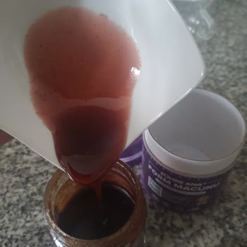 Trendyol Zühre Ana Form Macunu Yüzümü Mahvetti.