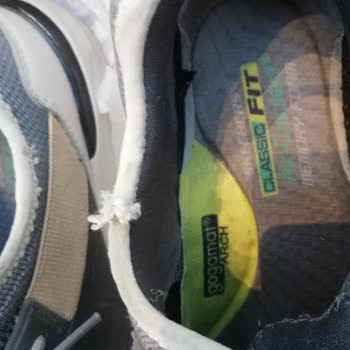 Skechers'ın Ürün Sorununu Kullanıcı Hatası Diye Başından Atması
