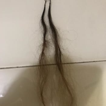 By Ahmet 26.000 Çöp Kaynak