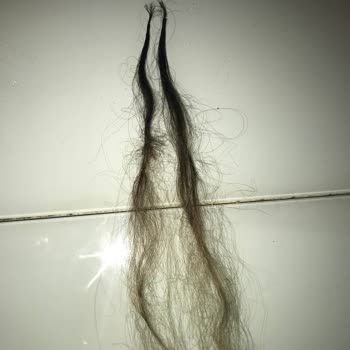 By Ahmet 26.000 Çöp Kaynak