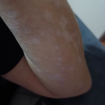 Ümran Tıp Merkezi Cildiye Doktorunun Tavrı!