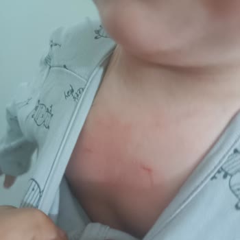 Mustela Stelatopia Krem Atopik Cilde Uygun Değil. Yakıyor, Pis Kokuyor