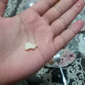 Tatbak Gıda Pasta İçinde Çıkan Tuhaf Şeyler