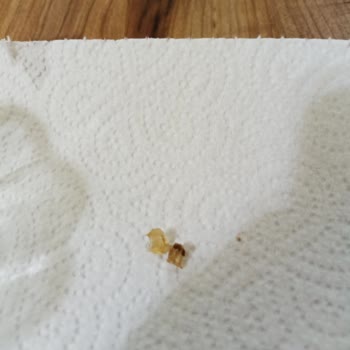 BİM Kapalı Paket İçinden Cam Çıkması