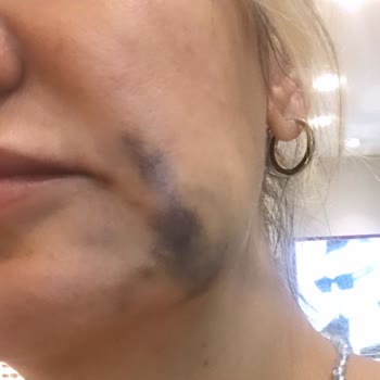 Victoria Güzellik Merkezi'nde Boşa Giden Param