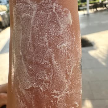 Gratis'ten Aldığım Celenes Güneş Kremi Bozuk Çıktı