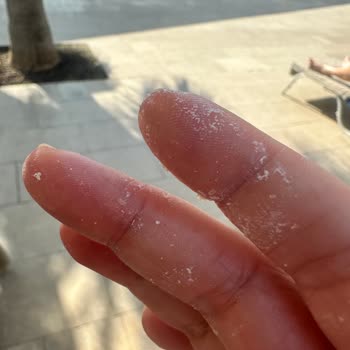 Gratis'ten Aldığım Celenes Güneş Kremi Bozuk Çıktı