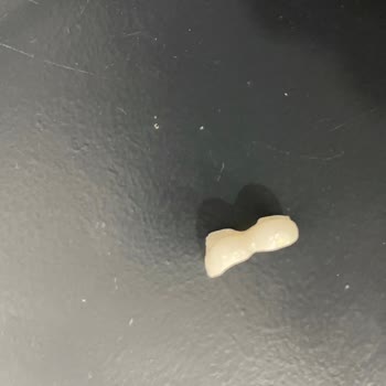 Cerrahi Grup Ağız ve Diş Sağlığı Polikliniği İmplant Üzeri Porselen Diş